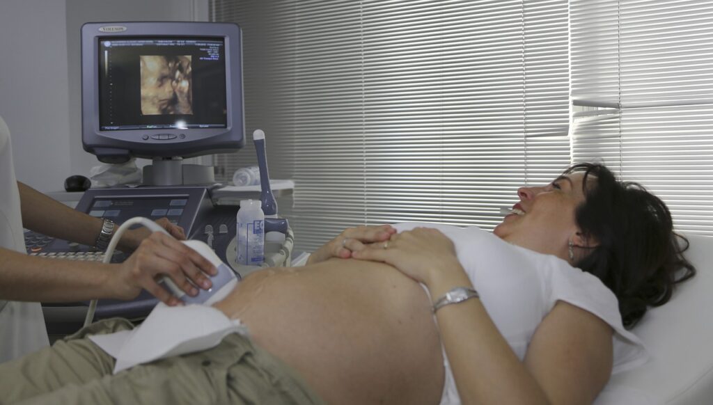 patient, ultrasound, pregnant, medical consultation, diagnosis, consultation, consulting room, ultrasound, ultrasound, ultrasound, ultrasound, ultrasound
